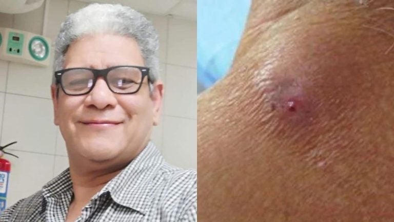 Médico cuestiona protocolos de la Sesal