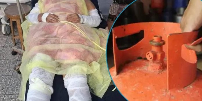 Explosión de cilindro de gas en Colón deja a dos hermanos con quemaduras graves