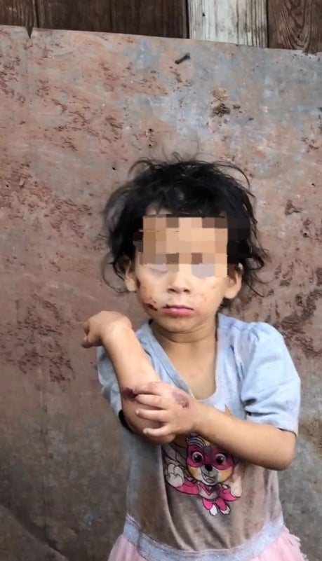 Denuncian a joven castigos inhumanos hacia sus hijas