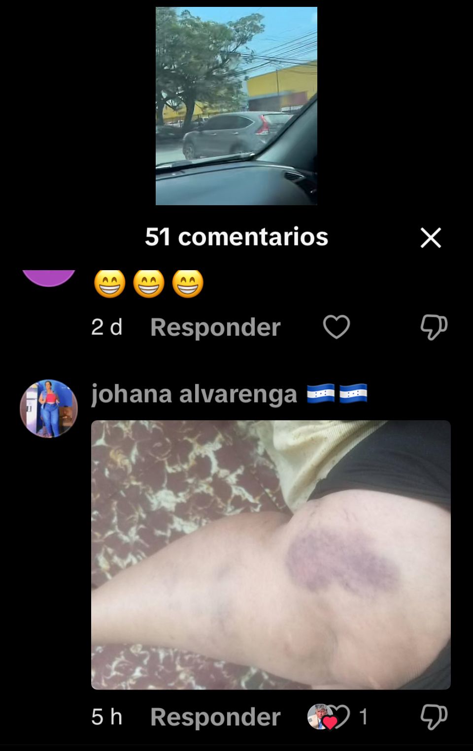 ¿Robo o escena de celos? Mujer queda tirada tras forcejear con puerta de vehículo en SPS 