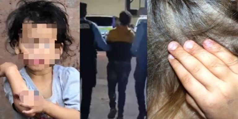 VIDEO: "Mamá me quemaba": El desgarrador testimonio de niña maltratada por su madre en la capital