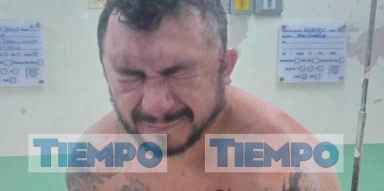 FOTOS | Rostros de los policías heridos por agente de la DLCN vinculado a brujería