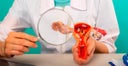 cancer-ovario2-blog