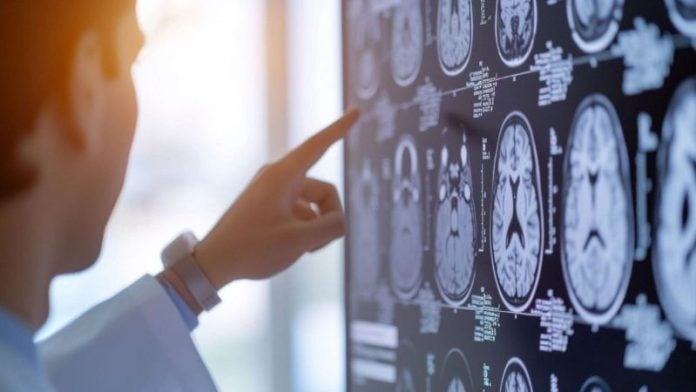 ¿Una bebida para el cerebro? Probióticos muestran potencial para frenar el Alzheimer