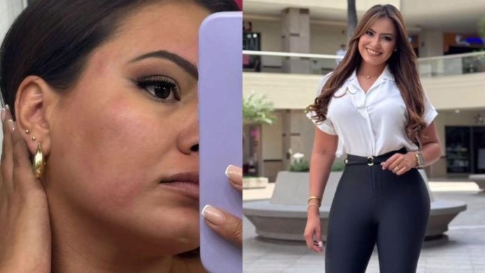 ¿Qué le pasó en la cara? Alejandra Rubio publica fotos que inquietan a sus seguidores