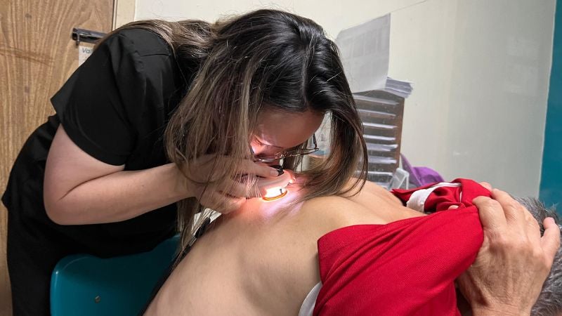 Evaluaciones cáncer de piel