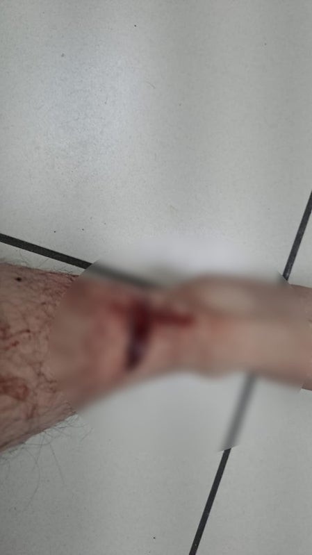 Policía Nacional resulta herido TGU