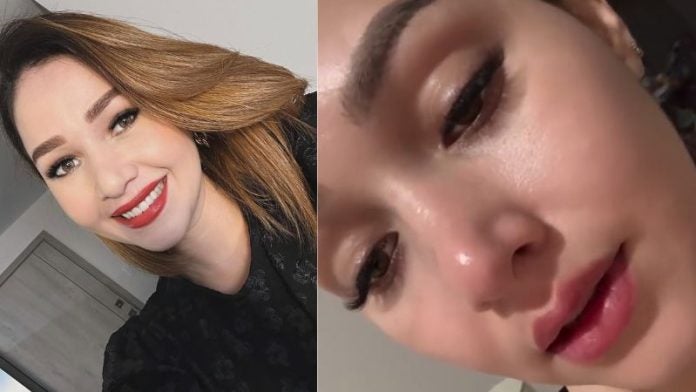 Jennifer Aplícano recaída por epilepsia