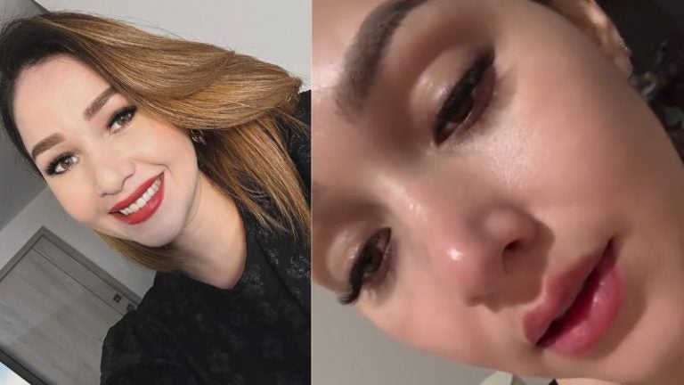Jennifer Aplícano recaída por epilepsia