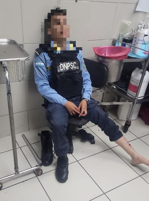 Policía Nacional resulta herido TGU