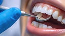 salud-dental