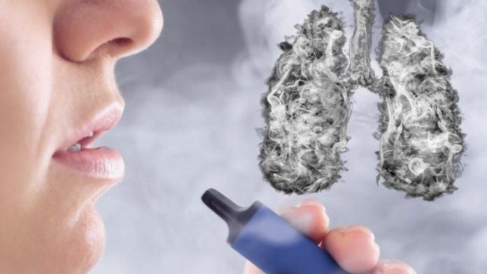 Vinculan oficialmente el vapeo con una enfermedad pulmonar irreversible