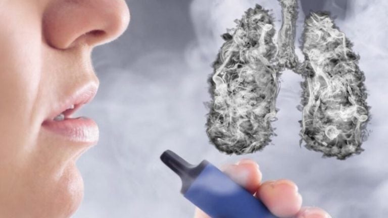 Vinculan oficialmente el vapeo con una enfermedad pulmonar irreversible