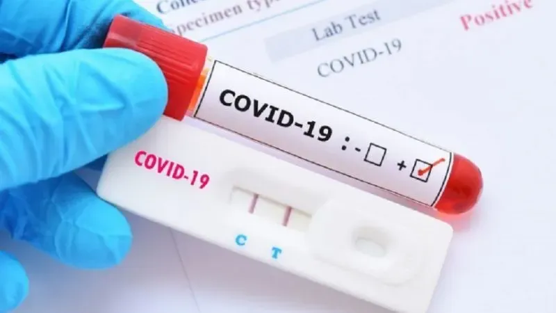 Médicos hondureños advierten sobre un brote de Covid-19 en el país