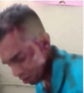 herido-bus-ulloa