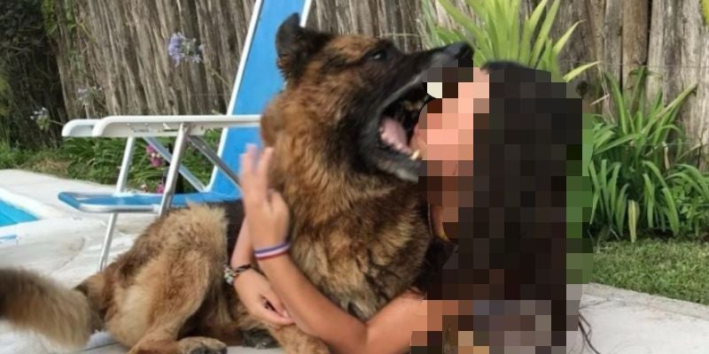 Pitbull ataca a niño y casi le arranca la oreja en TGU: madre exige justicia