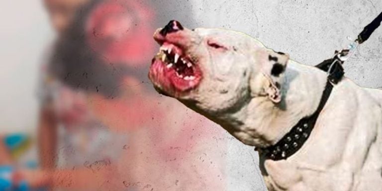 Pitbull ataca a niño y casi le arranca la oreja en TGU: madre exige justicia