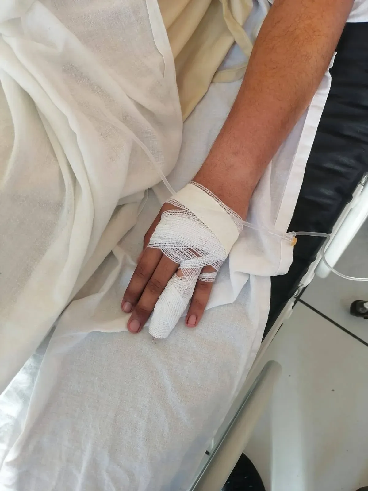 Foto de oficial herido, compartida por Policía Nacional. 