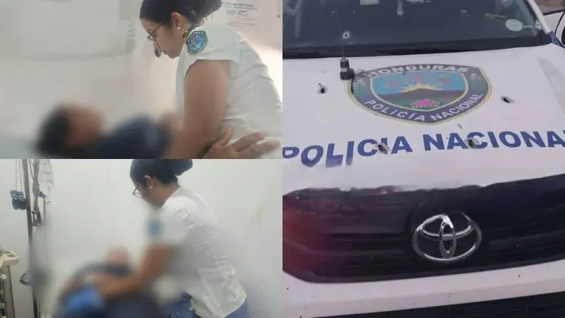 Policías heridas ataque Jacaleapa