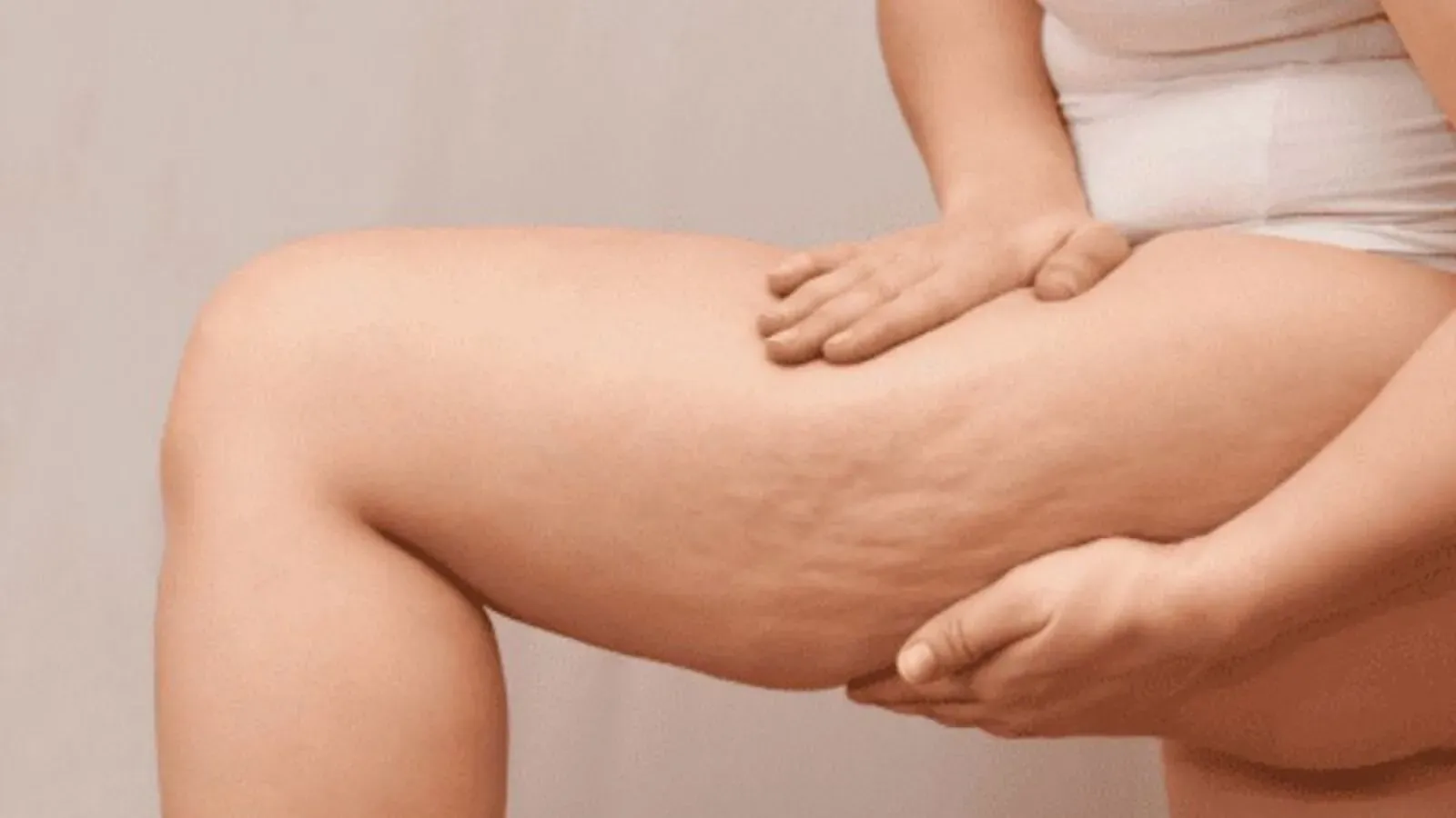 tratamientos contra la celulitis