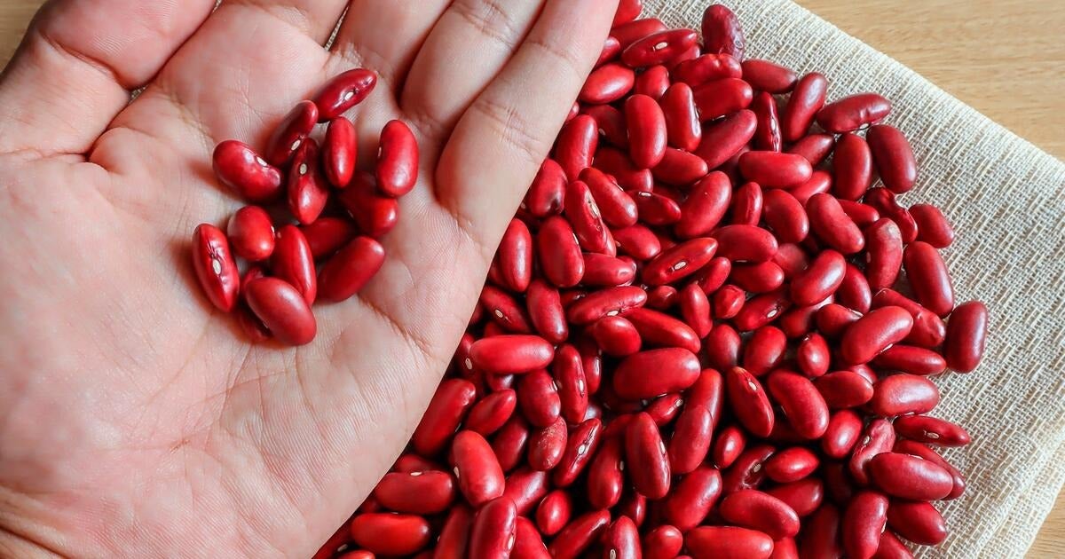 Bebé muere tras atragantarse con frijoles Alubarén