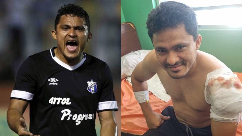 El ex jugador del Honduras Progreso, Jorge 