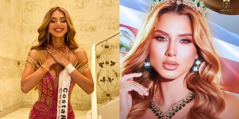 Miss Costa Rica hospitalizada tras grave accidente de tránsito