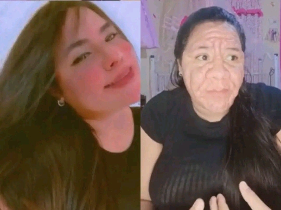 Venezolana rostro desfigurado embarazo