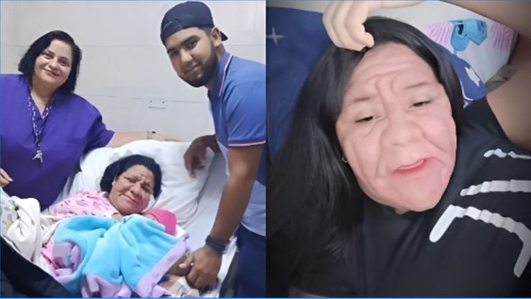 Venezolana deformación rostro embarazo