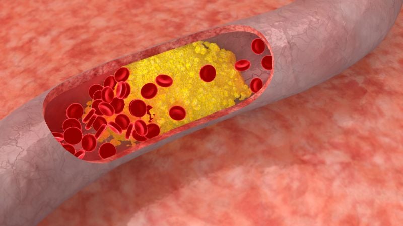 ideas sobre el colesterol