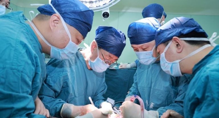 transplante