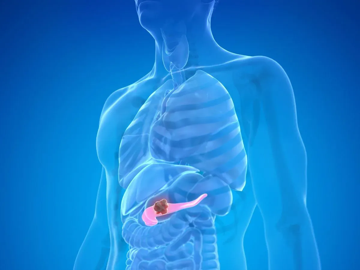 Vacuna contra cáncer de páncreas