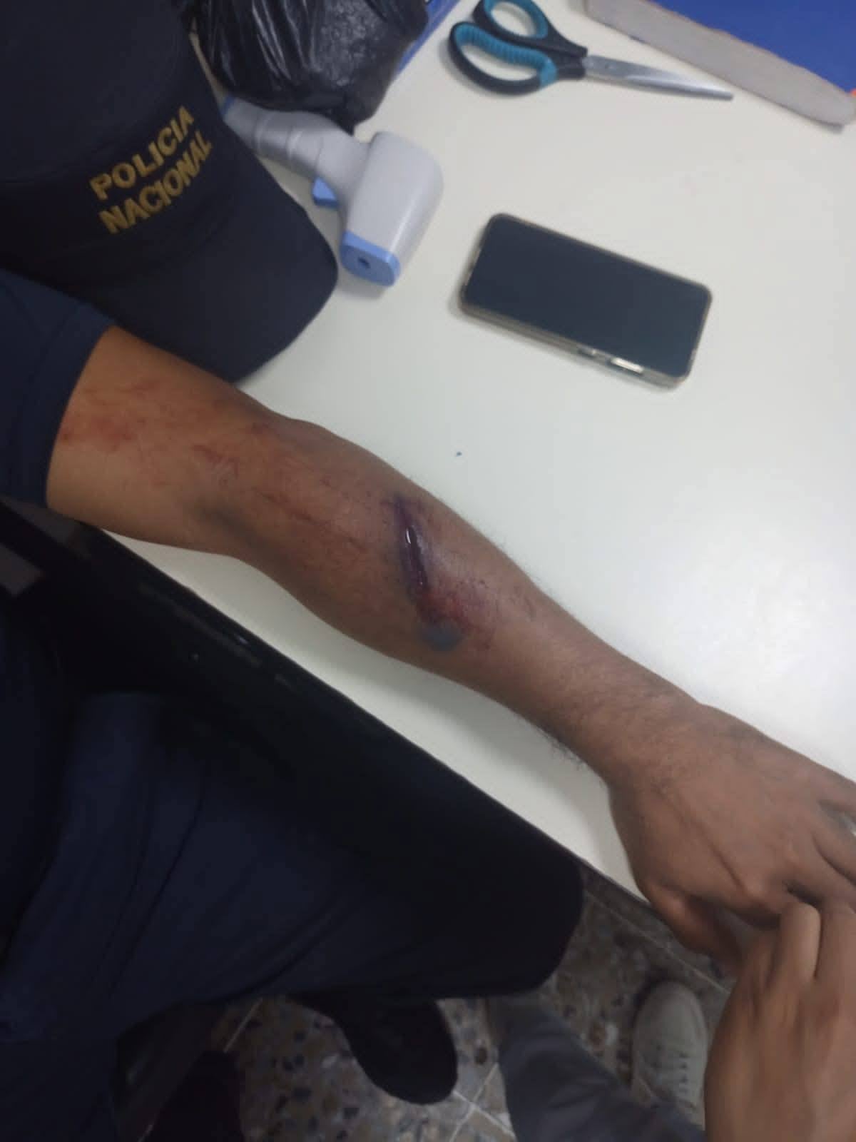 herido